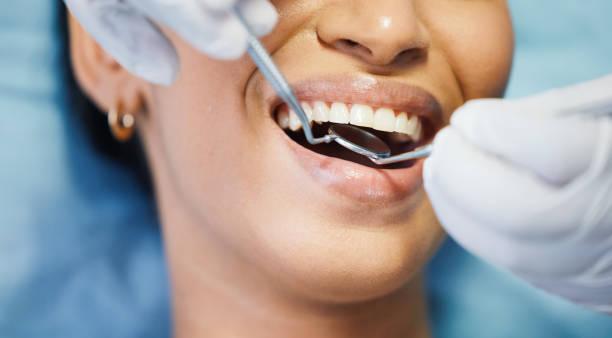 Best Emergency Dentist for Lost Fillings or Crowns in Steelville, MO